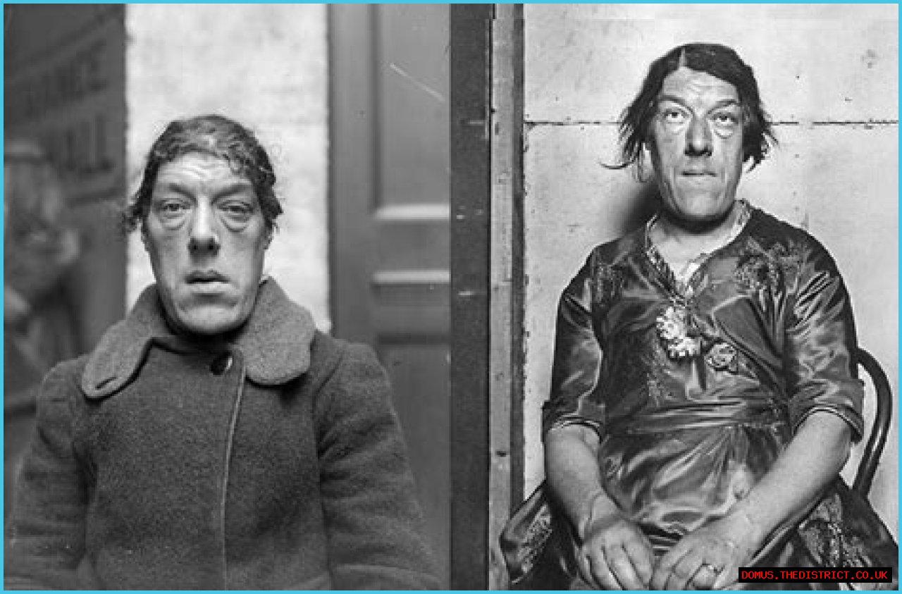 The Surprising Truth About Being Dubbed The Ugliest Person In The World